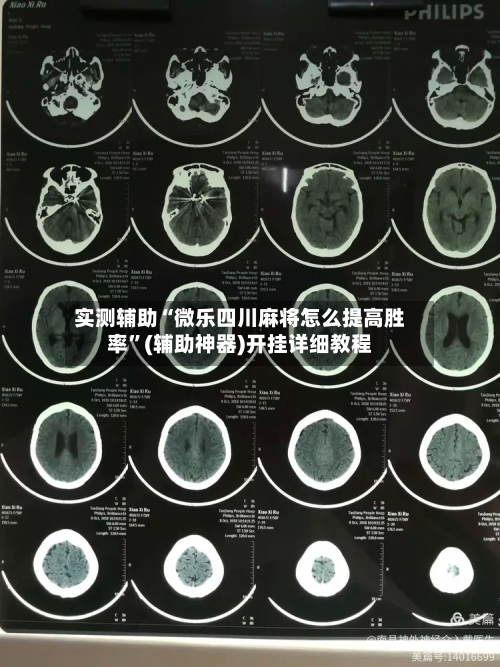 实测辅助“微乐四川麻将怎么提高胜率”(辅助神器)开挂详细教程-第1张图片