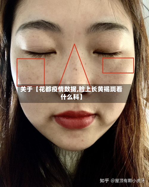 关于【花都疫情数据,脸上长黄褐斑看什么科】-第3张图片