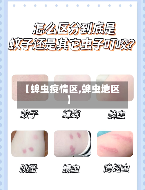 【蜱虫疫情区,蜱虫地区】-第1张图片
